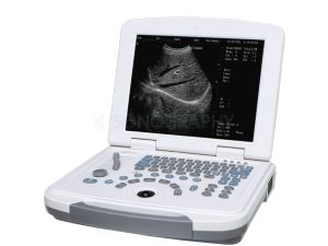 Изображение УЗИ аппарат BK Medical Pro Focus UltraView 800