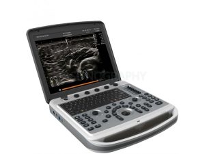 Изображение УЗИ аппарат Chison SonoTouch 80 EXP, (ST 80 EXP) (SonoBook 9)